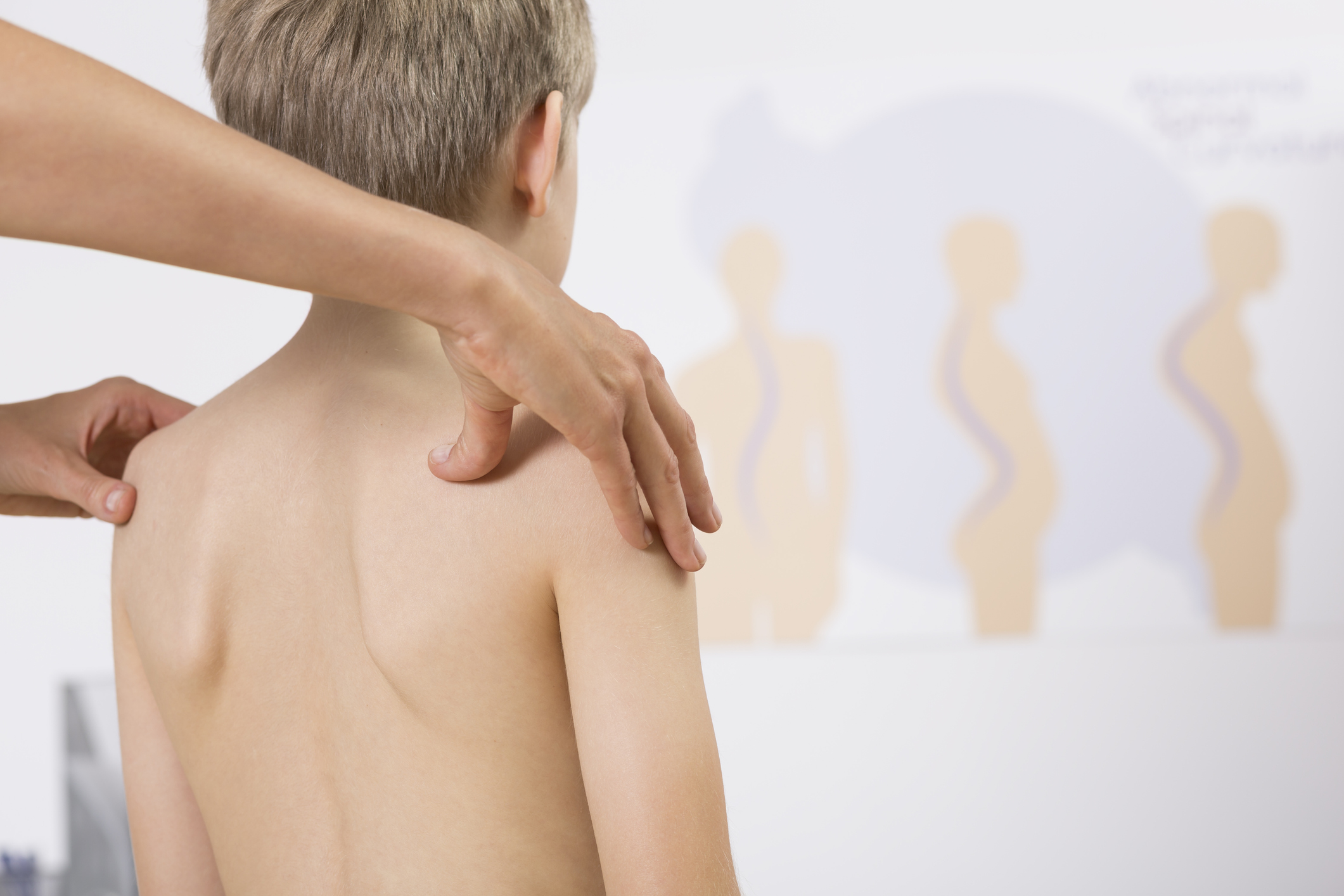 fisioterapia infantil